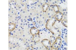 Immunohistochemistry of paraffin-embedded Mouse kidney using MTERFD3 Polyclonal Antibody at dilution of 1:100 (40x lens).