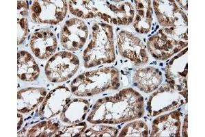Immunohistochemical staining of paraffin-embedded prostate tissue using anti-RC201933 mouse monoclonal antibody. (PIM2 抗体)