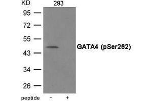 Western blot analysis of extracts from 293 cells using GATA4 (Phospho-Ser262) Antibody. (GATA4 抗体  (pSer262))