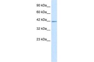 Western Blotting (WB) image for anti-IKAROS Family Zinc Finger 2 (IKZF2) antibody (ABIN2460270) (IKZF2 抗体)