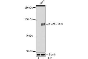 Western blot analysis of extracts of various cell lines, using Phospho-GYS1-S641 Rabbit mAb (ABIN7270761) at 1:1000 dilution. (Glycogen Synthase 1 抗体  (pSer641))