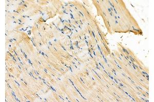 ABIN6260384 and ABIN6278087 at 1/100 staining Rat muscle tissue by IHC-P.