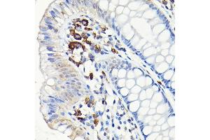 Immunohistochemistry of paraffin-embedded human colon using CD68 Rabbit pAb (ABIN6132070, ABIN6138218, ABIN6138221 and ABIN6217224) at dilution of 1:50 (40x lens). (CD68 抗体  (AA 22-319))