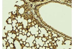 ABIN6269336 at 1/100 staining Mouse lung tissue by IHC-P. (FOXO1 抗体  (Internal Region))