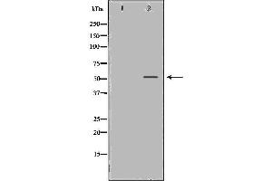 Western blot analysis of LoVo cell lysate, using MMP13 Antibody. (MMP13 抗体  (N-Term))