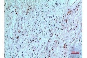 Immunohistochemistry (IHC) analysis of paraffin-embedded Human Brain, antibody was diluted at 1:100. (Thymidine Phosphorylase 抗体  (N-Term))