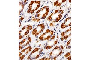 Immunohistochemical analysis of paraffin-embedded H. (Cytochrome C1 抗体  (AA 142-176))