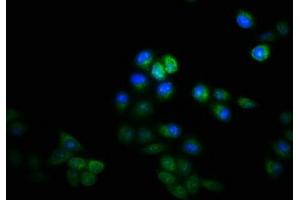 Immunofluorescence staining of Hela cells with ABIN7157464 at 1:133, counter-stained with DAPI. (KRT8 抗体  (AA 2-483))