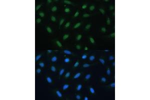 Immunofluorescence analysis of U-2 OS cells using  antibody (ABIN6127378, ABIN6137233, ABIN6137235 and ABIN6217480) at dilution of 1:100. (ATF3 抗体  (AA 1-181))