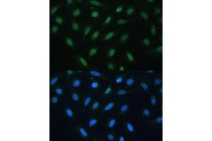 Immunofluorescence analysis of U-2 OS cells using  antibody (ABIN6127378, ABIN6137233, ABIN6137235 and ABIN6217480) at dilution of 1:100. (ATF3 抗体  (AA 1-181))