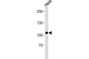 Western Blotting (WB) image for anti-Ubiquitin Protein Ligase E3C (UBE3C) antibody (ABIN3004610) (UBE3C 抗体)