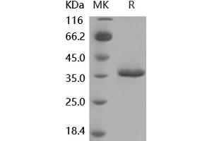 Western Blotting (WB) image for Secreted Frizzled-Related Protein 2 (SFRP2) protein (His tag) (ABIN7320429) (SFRP2 Protein (His tag))