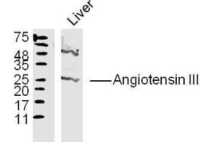 Liver lysates probed with Angiotensin III Polyclonal Antibody, Unconjugated  at 1:300 overnight at 4˚C. (Angiotensin III 抗体  (AA 35-41))