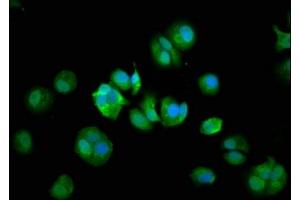 Immunofluorescence staining of MCF-7 cells with ABIN7148018 at 1:133, counter-stained with DAPI. (COPG2 抗体  (AA 676-823))