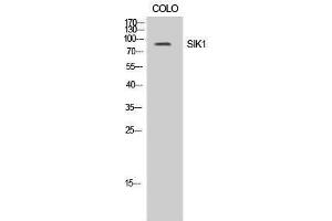 Western Blotting (WB) image for anti-Salt-Inducible Kinase 1 (SIK1) (Tyr86) antibody (ABIN3186959) (SIK1 抗体  (Tyr86))