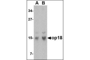 Western blot analysis of op18 in human brain tissue lysate with this product at (A) 0. (Stathmin 1 抗体  (N-Term))