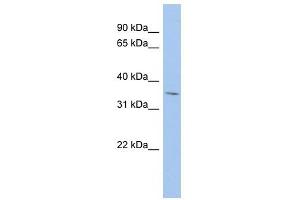 MPST antibody used at 1 ug/ml to detect target protein. (MPST 抗体  (Middle Region))