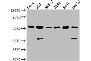 Western Blot Positive WB detected in: Hela whole cell lysate, 293 whole cell lysate, MCF-7 whole cell lysate, A549 whole cell lysate, Raji whole cell lysate, HepG2 whole cell lysate All lanes: SMAD1 antibody at 3 μg/mL Secondary Goat polyclonal to rabbit IgG at 1/50000 dilution Predicted band size: 53, 16 kDa Observed band size: 53 kDa