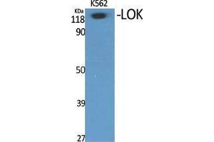 Western Blot (WB) analysis of specific cells using LOK Polyclonal Antibody. (STK10-A 抗体  (Internal Region))