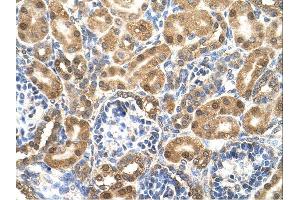 Enolase 3 antibody was used for immunohistochemistry at a concentration of 4-8 ug/ml. (ENO3 抗体)