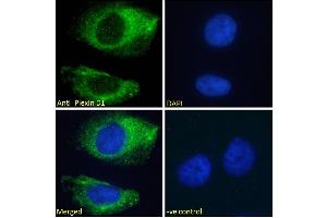 ABIN185358 Immunofluorescence analysis of paraformaldehyde fixed HeLa cells, permeabilized with 0. (PLXND1 抗体  (Internal Region))