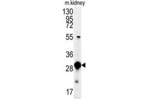 Western Blotting (WB) image for anti-Mercaptopyruvate Sulfurtransferase (MPST) antibody (ABIN3003390)
