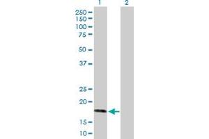 Western Blot analysis of AHNAK expression in transfected 293T cell line by AHNAK MaxPab polyclonal antibody. (AHNAK 抗体  (AA 1-149))