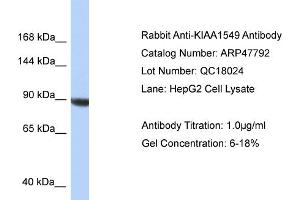 WB Suggested Anti-KIAA1549 Antibody   Titration: 1. (KIAA1549 抗体  (C-Term))