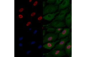 ABIN6263715 and ABIN6277123 staining  cells by IF/ICC.