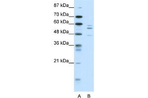 WB Suggested Anti-PAX6 Antibody Titration:  0. (PAX6 抗体  (N-Term))