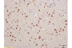 Formalin-fixed and paraffin embedded rat brain labeled with Anti-phospho-Histone H1. (HIST1H1E 抗体  (pThr18))