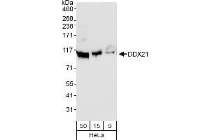anti-DEAD (Asp-Glu-Ala-Asp) Box Polypeptide 21 (DDX21) (AA 50-100) antibody