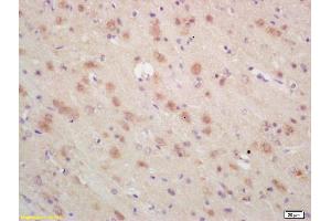 Formalin-fixed and paraffin embedded rat brain labeled with Rabbit Anti ARP3 Polyclonal Antibody, Unconjugated (ABIN1387419) at 1:200 followed by conjugation to the secondary antibody and DAB staining (ANGPTL6 抗体  (AA 301-400))