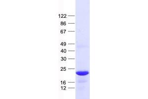 Western Blotting (WB) image for Hairy and Enhancer of Split 5 (HES5) protein (His tag) (ABIN2722666)
