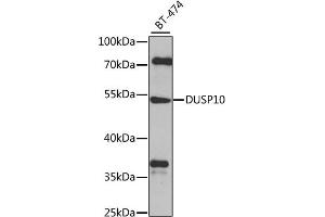 Western blot analysis of extracts of BT-474 cells, using DUSP10 antibody (ABIN6127786, ABIN6139859, ABIN6139860 and ABIN6224777) at 1:1000 dilution. (DUSP10 抗体  (AA 1-300))