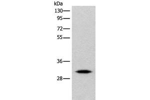 Western blot analysis of Human cerebrum tissue lysate using IMPA1 Polyclonal Antibody at dilution of 1:360 (IMPA1 抗体)