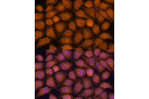 Immunofluorescence analysis of HeLa cells using TNFL2 antibody (ABIN6133093, ABIN6149298, ABIN6149299 and ABIN6217788) at dilution of 1:100.