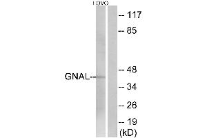 Immunohistochemistry analysis of paraffin-embedded human brain tissue using GNAL antibody. (GNAL 抗体  (Internal Region))