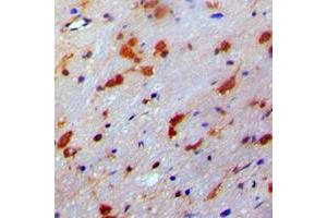 Immunohistochemical analysis of PDRG1 staining in human brain formalin fixed paraffin embedded tissue section. (PDRG1 抗体  (Center))