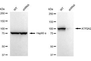 Western blotting analysis using ATP2A2 antibody (ABIN7797694).