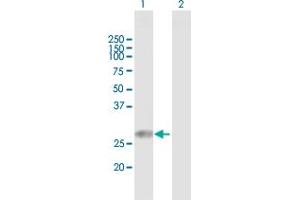Western Blot analysis of TPD52L2 expression in transfected 293T cell line by TPD52L2 MaxPab polyclonal antibody. (TPD52L2 抗体  (AA 1-206))