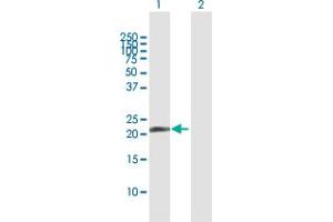 Western Blot analysis of PDE4DIP expression in transfected 293T cell line by PDE4DIP MaxPab polyclonal antibody. (PDE4DIP 抗体  (AA 1-177))