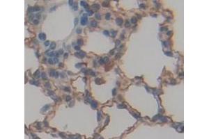 Used in DAB staining on fromalin fixed paraffin- embedded Kidney tissue (NOTCH4 抗体  (AA 1690-1945))
