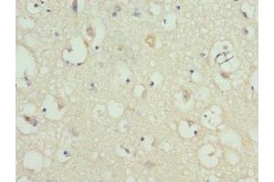 Immunohistochemistry of paraffin-embedded human brain tissue using ABIN7157743 at dilution of 1:100 (KCNIP2 抗体  (AA 1-90))