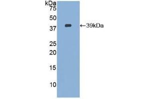 Western blot analysis of recombinant Human CVL. (Ezrin 抗体  (AA 1-295))