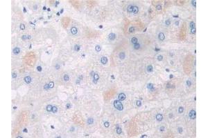 IHC-P analysis of Human Liver Tissue, with DAB staining. (APPL1 抗体  (AA 404-673))