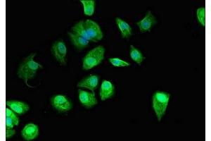 Immunofluorescent analysis of MCF-7 cells using ABIN7165618 at dilution of 1:100 and Alexa Fluor 488-congugated AffiniPure Goat Anti-Rabbit IgG(H+L) (C22orf13 抗体  (AA 1-136))