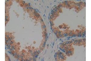 IHC-P analysis of Human Prostate Tissue, with DAB staining. (Proteoglycan 4 抗体  (AA 1151-1241))