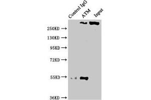 Immunoprecipitating ATM in PC3 whole cell lysate Lane 1: Rabbit control IgG instead of ABIN7127350 in PC3 whole cell lysate. (Recombinant ATM 抗体)