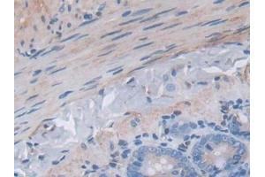 Detection of JNK1 in Rat Small intestine Tissue using Polyclonal Antibody to c-Jun N-terminal Kinase 1 (JNK1) (C-Jun N-Terminal Kinases (AA 138-370) 抗体)